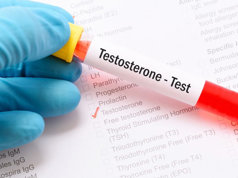 Testosterone replacement therapy (TRT) Men Health