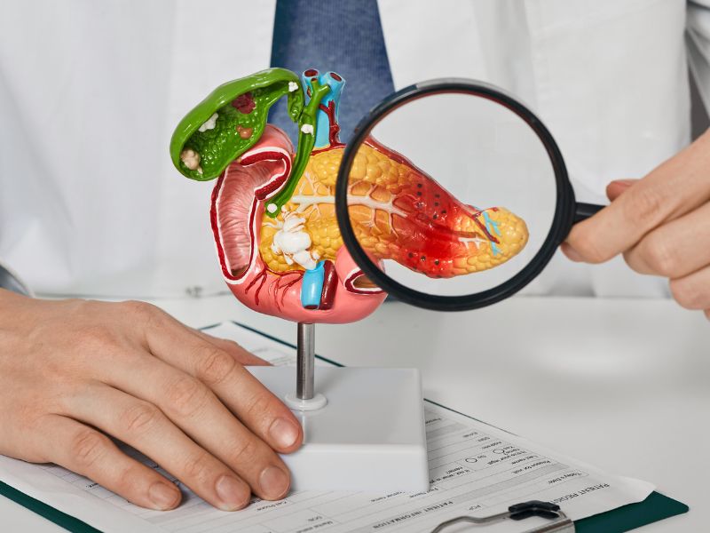 Who Uses Bile Salts Supplements & Global Trends