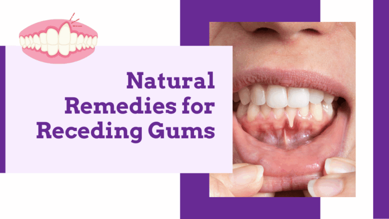 Natural Remedies for Receding Gums Effective Ways to Restore Gum Health