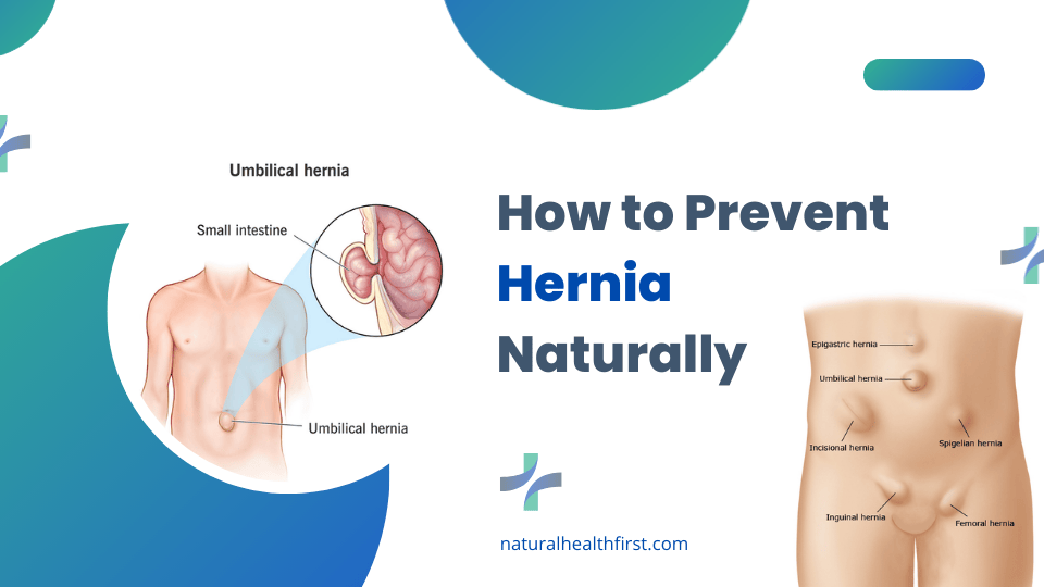 How to Prevent Hernia Naturally Best Natural Prevention Methods