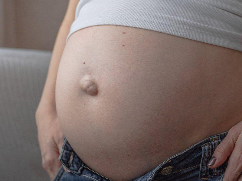 Prevent a Hernia in Pregnancy Special Considerations